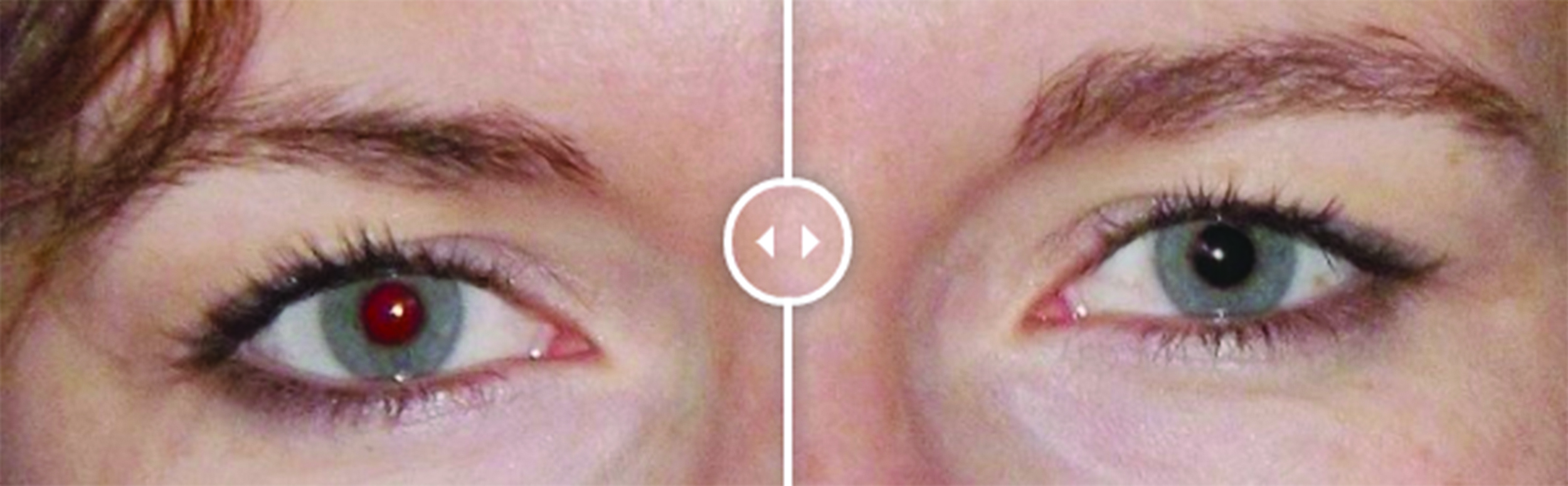 Почему возникает эффект красных глаз на фото