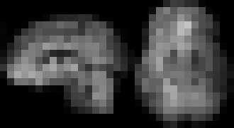 Photo Nové 3D MRI ukazuje mozog v detailoch, aké sme nikdy predtým nevideli