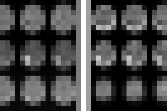 Photo Nové zariadenie MRI na snímkovanie mozgu je menšie, mobilné a podstatne lacnejšie