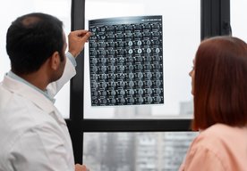 Photo Röntgenové lúče selektívne ničia bunky mozgového nádoru 