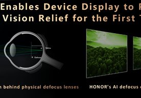 Photo  HONOR predstavuje prvú ochranu očí proti krátkozrakosti  a detekcii falošných obrázkov založenú na umelej inteligencii 