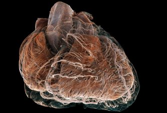 Photo Unikátna technológia umožňuje porovnať ako vyzerá zdravé a choré srdce 