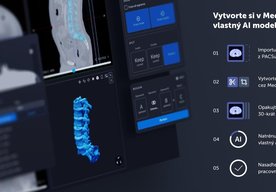 Photo Slovenská platforma Medannot na automatizáciu rádiologických vyšetrení vďaka AI získala investíciu vo výške 300-tisíc eur 